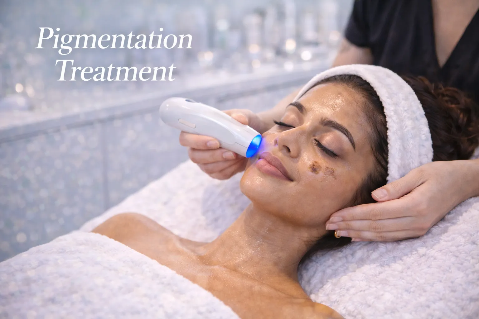 Pigmentation Treatment